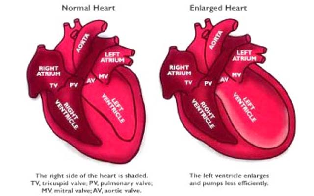 WHEN YOUR HEART’S BROKEN... (LITERALLY)