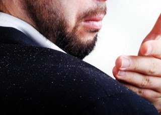 Get Rid of Dandruff Naturally!