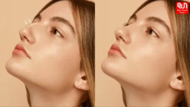 Rhinoplasty