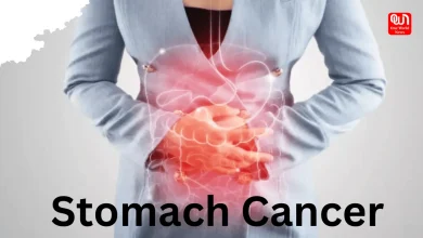 Stomach Cancer