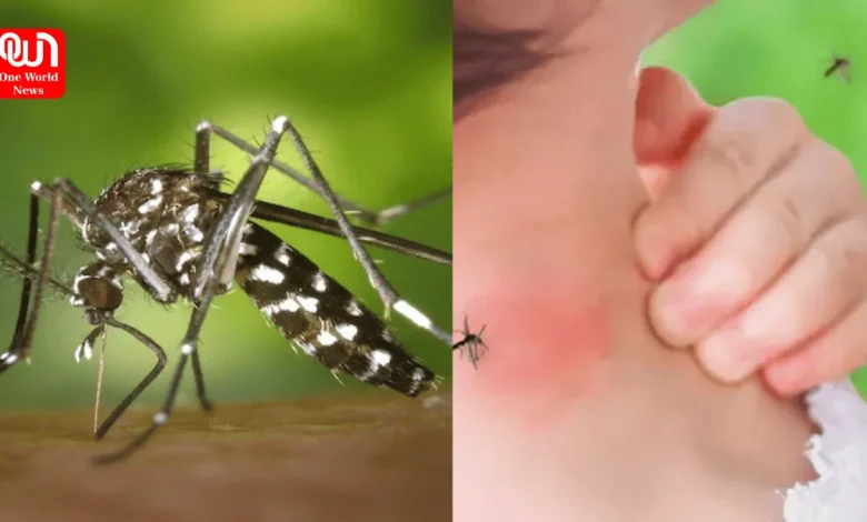 Signs Of Dengue Fever