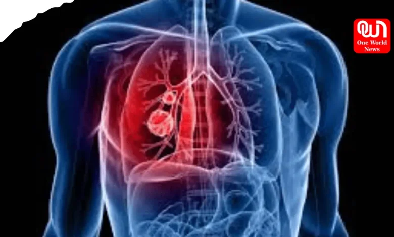Warning Signs Of Lung Cancer