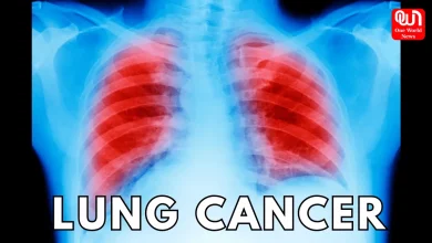 lung cancer