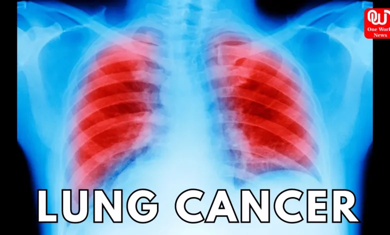 lung cancer
