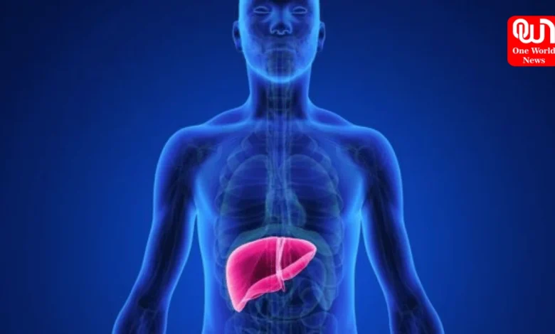 Non-alcoholic steatohepatitis