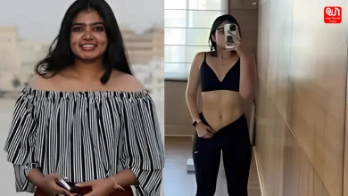 Transformative Weight Loss of Woman