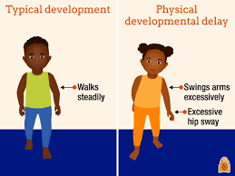 Developmental Delays