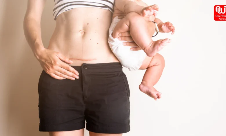 Postpartum Recovery
