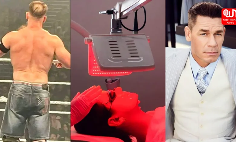 Hair Transplant, Red-Light Therapy, John Cena