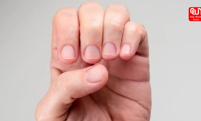 Short Nail Beds