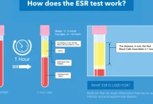 ESR Test