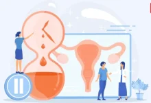 Perimenopause