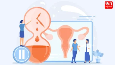 Perimenopause