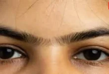 Unibrows
