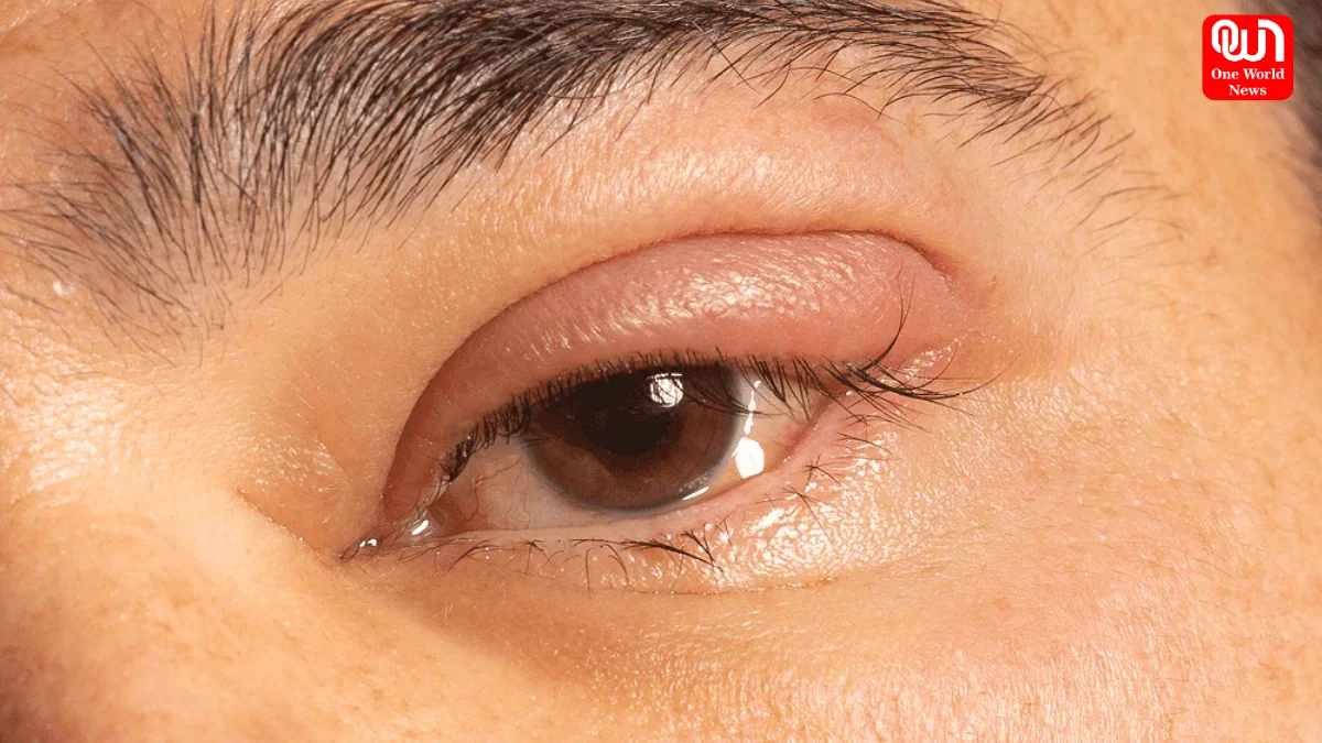 Rid Of Puffy Eyes After Crying