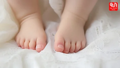 Clubfoot in Newborns